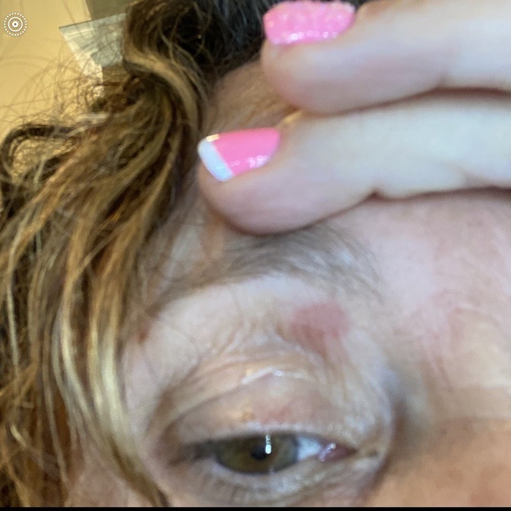 Super Nails One - Burn from wax - Nail Salons Near Me - Long Beach, California Super Nails One - Burn from wax - Nail Salons Near Me - Long Beach, California