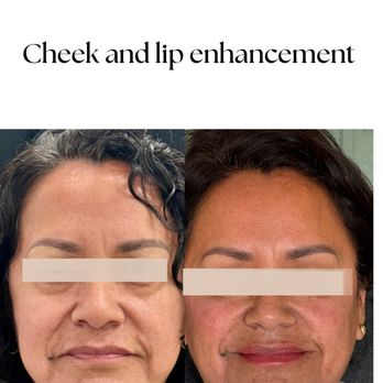 Skin Gratitude - Medical Spas Near Me - Brea, California Skin Gratitude - Medical Spas Near Me - Brea, California