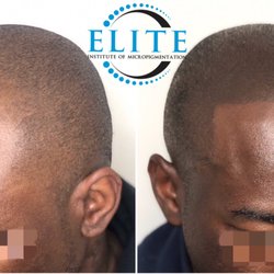 Scalp Masters Atlanta