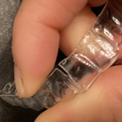 Molen Orthodontics - Invisalign tray