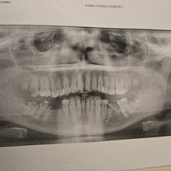 Brunswick Dental Associates - You can see that my teeth are in bad shape, but not so bad that every single one of 30 teeth need to be pulled out like she said.