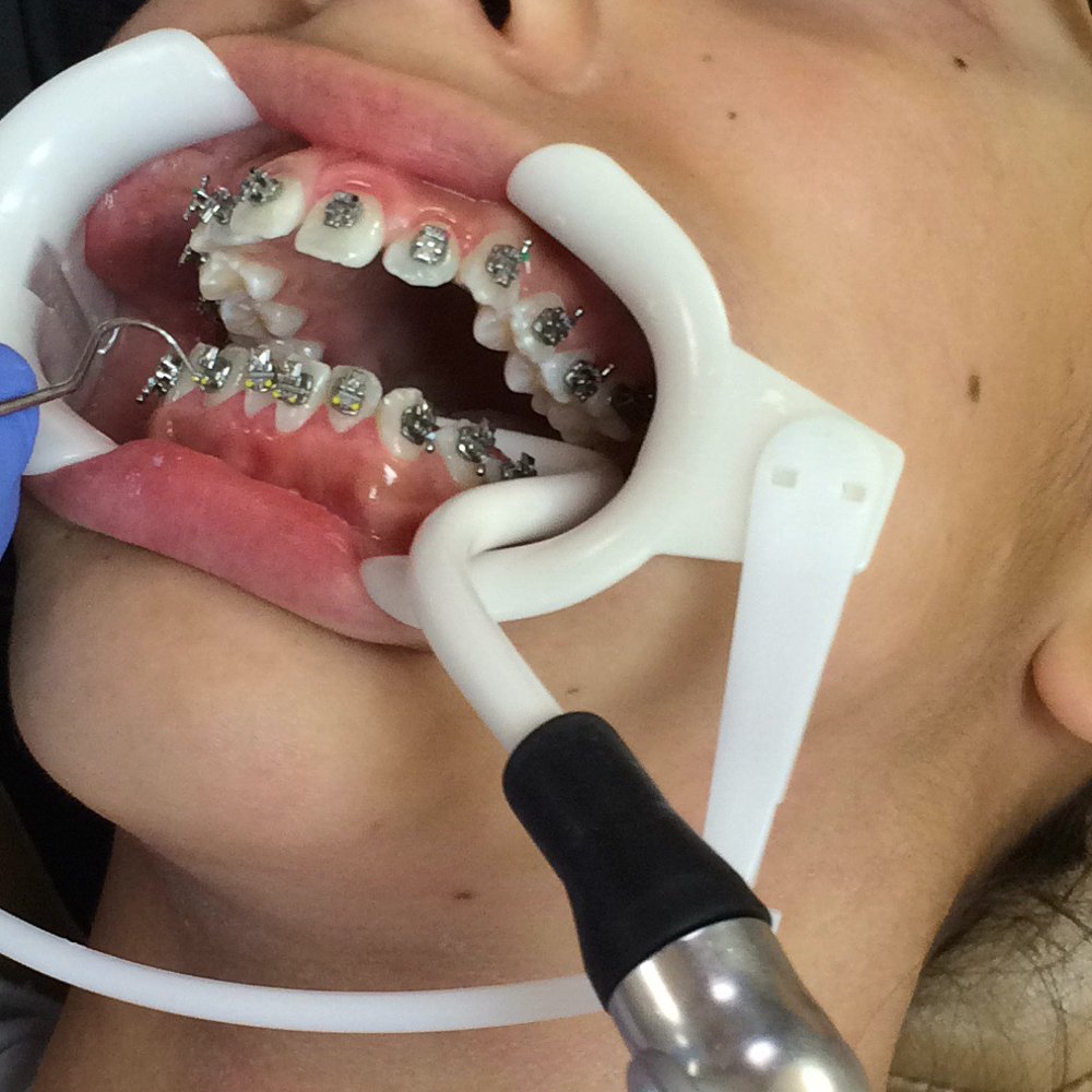 Bernstein Orthodontics - Windsor - Orthodontists Near Me - Windsor, California Bernstein Orthodontics - Windsor - Orthodontists Near Me - Windsor, California