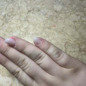 Future Nails - bleeding pinky - Nail Salons Near Me - Hickory, North Carolina