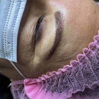 Pure Beauty Day Spa - Microshadding before and after photos - Skin Care Near Me - Vancouver, Washington Pure Beauty Day Spa - Microshadding before and after photos - Skin Care Near Me - Vancouver, Washington