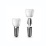 Photo of Louisville Dentures and Implants