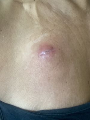 Maryland Hematology & Oncology