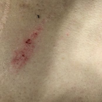 Escapade Games - Battle scars from my friend. Be careful when you run for your life!!! - Escape Games Near Me - Fullerton, California Escapade Games - Battle scars from my friend. Be careful when you run for your life!!! - Escape Games Near Me - Fullerton, California