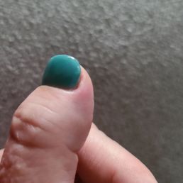 Sore thumb