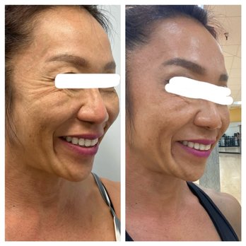 Aloha Aesthetics MD - Medical Spas Near Me - Honolulu, Hawaii Aloha Aesthetics MD - Medical Spas Near Me - Honolulu, Hawaii