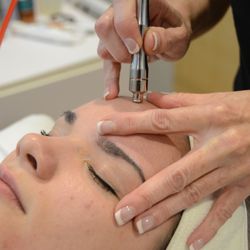 Skinticians - Microdermabrasion polishes the skin and removes redundant dead skin cell build up.