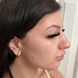 Mitchell Plastic Surgery/Contours and Curves - BEFORE SIDE PROFILE