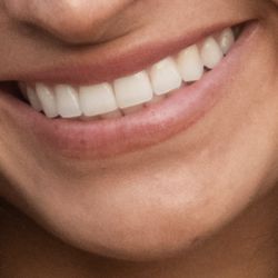 Marina View Dentistry - My natural teeth thanks to Dr. Guinan and her staff!