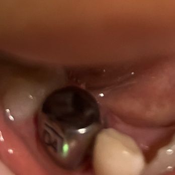 Apple Dental Care - Pediatric Dentists Near Me - Chicago, Illinois Apple Dental Care - Pediatric Dentists Near Me - Chicago, Illinois