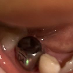 Apple Dental Care