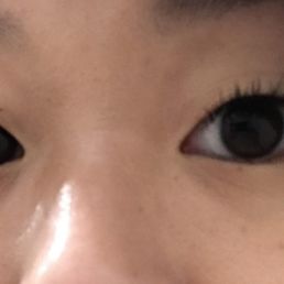 Month 1 Month 1