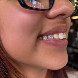 Tooth gem