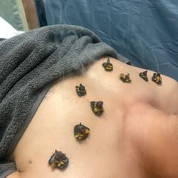 Del Sol Therapies - Moxibustion for chronic cough