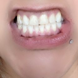 Soheil Rashidchi, DDS - Rockville Dental Care - How clean she got them
