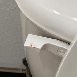 Blood on toilet?
