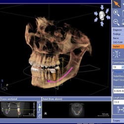 Michael J Scoles DMD - We have 3D Xray imaging on site!