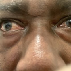 The Vanguard Eye Institute - The next morning seeing I can read tiny print again!!! I'm so damn excited Thank you Dr. Christian you are one of the best healer!!!