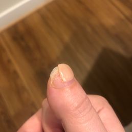 Polish cracked and chipped off
