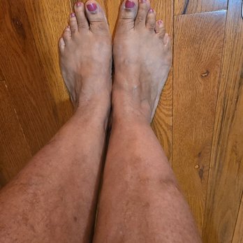 Buckner Vein and Aesthetics - Radiologists Near Me - Eldersburg, Maryland