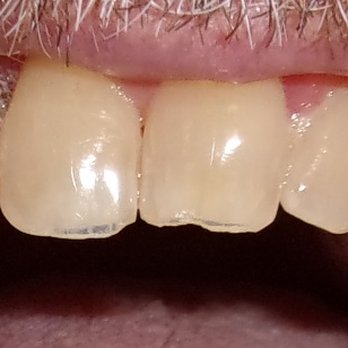 KidsKare - The stark difference in color and size - General Dentistry Near Me - Roswell, New Mexico KidsKare - The stark difference in color and size - General Dentistry Near Me - Roswell, New Mexico