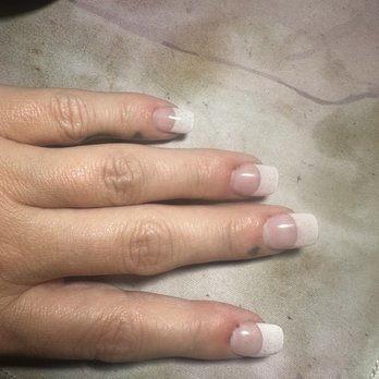 Elite Nails and Spa - Torn and bleeding cuticles - Nail Salons Near Me - Arvada, Colorado Elite Nails and Spa - Torn and bleeding cuticles - Nail Salons Near Me - Arvada, Colorado