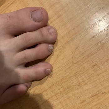 Nailed - Toenails are not even cut or filed. - Nail Salons Near Me - Millcreek, Utah