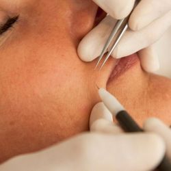 Divine 9 Spa Services - Electrolysis