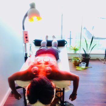 Malama Ola - Cupping therapy for pre/post surfing. - Acupuncture Near Me - Honolulu, Hawaii Malama Ola - Cupping therapy for pre/post surfing. - Acupuncture Near Me - Honolulu, Hawaii