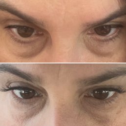 Before and after lashes Before and after lashes
