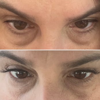 Wonder eyelash Extension - Before and after lashes - Eyelash Service Near Me - Scarsdale, New York Wonder eyelash Extension - Before and after lashes - Eyelash Service Near Me - Scarsdale, New York