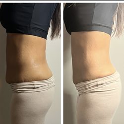 Bawdy Nirvana - Skin tightening and fat reduction