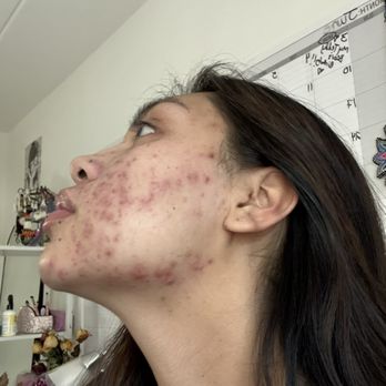 Pure Aesthetica - Skin Care Near Me - Alexandria, Virginia Pure Aesthetica - Skin Care Near Me - Alexandria, Virginia