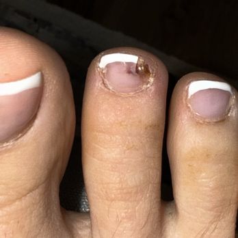 Nail Boss - Toe nail now infected after 3 weeks - Nail Salons Near Me - San Diego, California