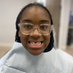 Vanguard Orthodontics - Fulton - Before