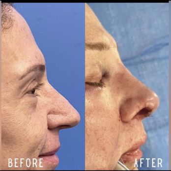 Ariel Ourian, MD - Plastic Surgeons Near Me - Beverly Hills, California