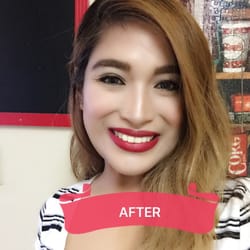 Precilyn B Silvestre, DDS - I have not smiled this big before. Dr. Silvestre-Melo made it possible for me to be completely genuinely happy.