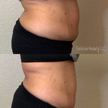 EnVision Beauty - Teeth Whitening Near Me - Santa Rosa, California EnVision Beauty - Teeth Whitening Near Me - Santa Rosa, California
