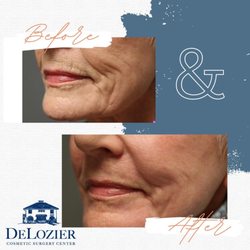 DeLozier Cosmetic Surgery Center