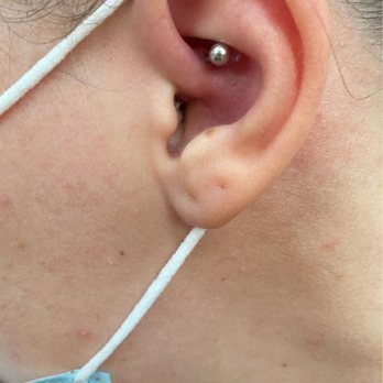 Black List Tattoo & Piercing - Infected daith. Incorrectly pierced - Tattoo Near Me - Pearland, Texas