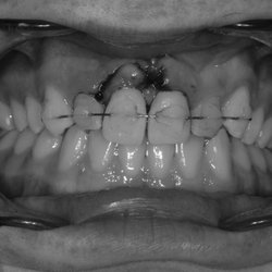 Paso Robles Endodontics