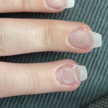 Divine Nail Spa - Cracked up to the base of my nail - Nail Salons Near Me - Haymarket, Virginia