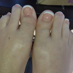 VNAILS