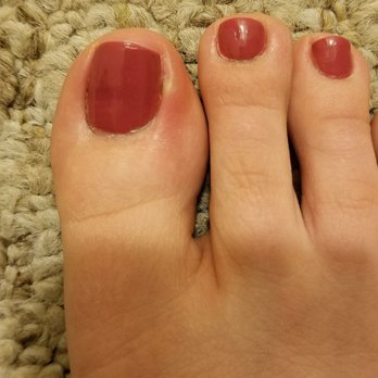 Gloss Nails Spa - Infected toe - Nail Salons Near Me - Walnut Creek, California