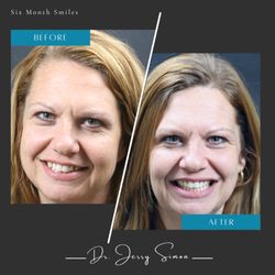 Dental Care of Stamford - What started as a wish for straighter teeth became a journey toward self-confidence -- and a smile that says it all.