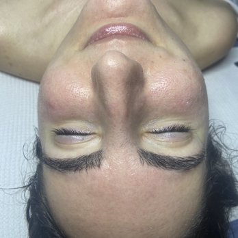 Kibali - This is the after and my skin felt and looked wonderful! - Medical Spas Near Me - Boca Raton, Florida Kibali - This is the after and my skin felt and looked wonderful! - Medical Spas Near Me - Boca Raton, Florida