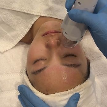 V Beauty - Microneedling facial treatment - Permanent Makeup Near Me - San Jose, California V Beauty - Microneedling facial treatment - Permanent Makeup Near Me - San Jose, California